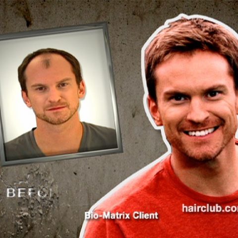 Hair Club – Can You Tell?