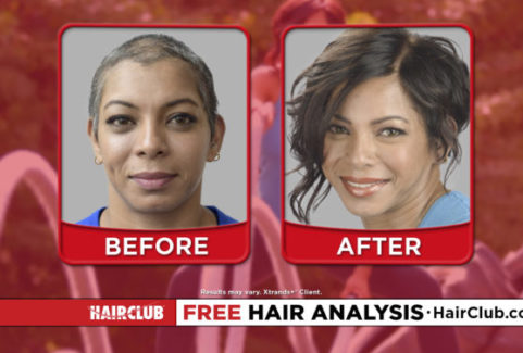 Hair Club – All You Got To Do